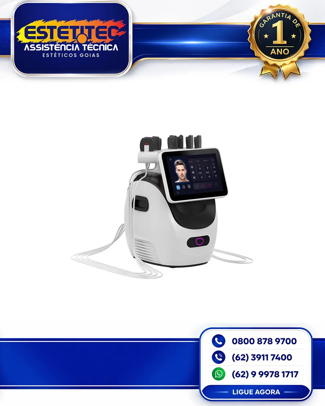 REPARO NEWANGIE 755NM CURITIBA